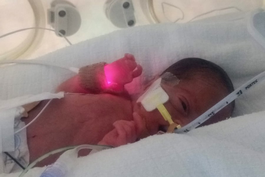 פגה באינקובטור